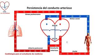 Circuito de la persistencia del conducto arterioso [upl. by Josler478]