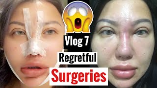 REGRETFUL SURGERIES  PERMANENT FILLERS AQUAMID  VLOG EP7 [upl. by Lorou637]