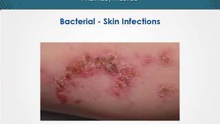 Bacterial skin infections  Dermatology  EduRx [upl. by Knobloch101]