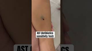 Antibiotics Sensitivity Test sensitivity nurses ytshots youtubeshorts subscribers [upl. by Neivad159]