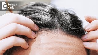 What causes premature greying of hair in young individuals  Dr Aruna Prasad [upl. by Alek35]