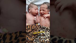 Adorable Twin Newborn Babies immediately AfterBirth [upl. by Eeleak]