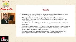 Pulmonary Lymphangitis Carcinomatosis [upl. by Ybrik]