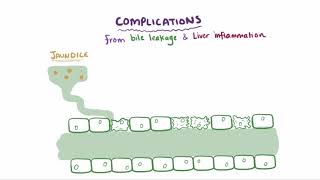 Primary biliary cholangitis causes symptoms diagnosis treatment amp pathology [upl. by Ailliw]