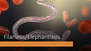 BIOLOGY Chapter 10 Human Diseases Filariasis Elephantiasis HSC New Syllabus [upl. by Yekcin]