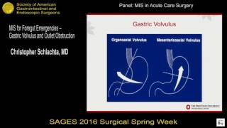 MIS for foregut emergencies  gastric volvulus and outlet obstruction [upl. by Ayat]