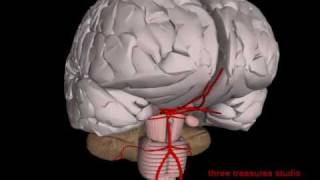 intracranial aneurysm and the 3D brain [upl. by Guyon]