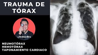 ATLS  Trauma de tórax  ENARM2021  🩺Dr Treviño [upl. by Reinhardt311]