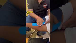 Therapeutic taping taping tenniselbow elbowpain drshubh [upl. by Kir]