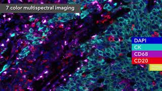 PerkinElmer  7Color Multispectral Imaging with Vectra Polaris [upl. by Odericus414]