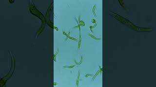 nematode with symbiotic cyanobacteria [upl. by Aikenat]