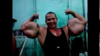 Synthol Nightmare [upl. by Otilesoj]