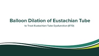 Balloon Dilation of Eustachian Tube to treat Eustachian Tube Dysfunction [upl. by Aizan]