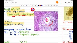 GIT PARA REV II Trematodes amp cestodes [upl. by Mandeville415]