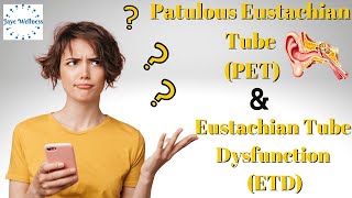 Patulous Eustachian Tube Compared To Eustachian Tube Dysfunction  Ways to Help You Heal [upl. by Padgett]