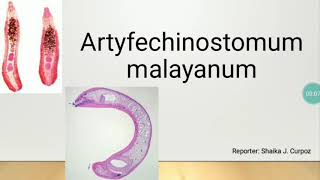 Artyfechinostomum Malayanum TREMATODE [upl. by Yajiv]