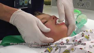 Paediatric Anaesthetics Chapter 1  Mask anaesthesia after iv induction [upl. by Asilehc]