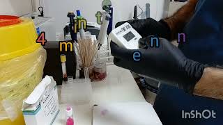 2ME Test2Mercaptoethanol پشکنینی [upl. by Odel]