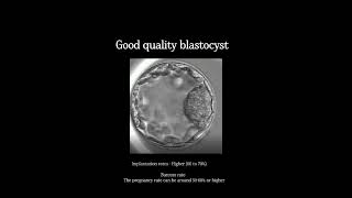 Blastocyst morphology  Nova IVF novaivffertility madurai blastocyst blastocysttransfer [upl. by Nerret476]