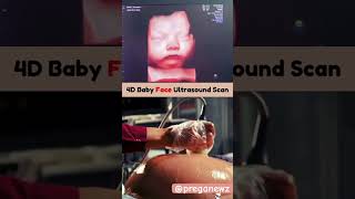 Pregnancy ultrasound and baby movement in womb pregnancycare pregancyultrasound pregnancy [upl. by Edmonda]