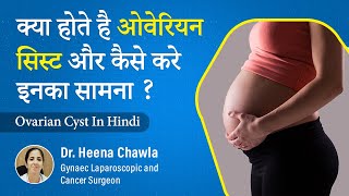 Ovarian Cysts Types Symptoms Treatment amp More in Hindi  Dr Heena Chawla [upl. by Neirb285]