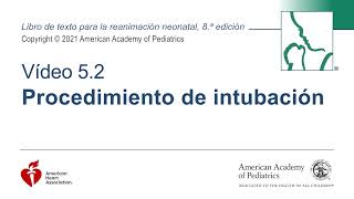 Procedimiento de Intubación Neonatal [upl. by Anestassia]