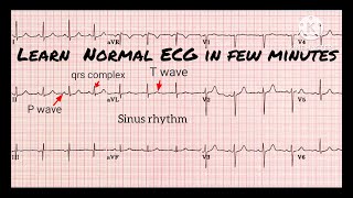 ECG test  ECG interpretation made easy  ECG report kaise dekhe  ECG reading  ECG dekhna sikhe [upl. by Marcus450]