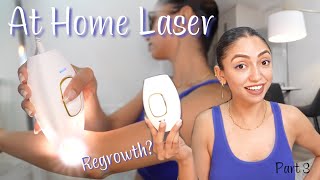 Laser Hair Removal at Home  Is is Effective  My Review  Permanent Hair Removal [upl. by Inaboy]