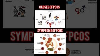 Polycystic Ovarian Syndromepcos pcod pcodtreatment pcosawareness pcosinfertility pcoslifestyle [upl. by Adey]