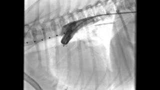 Patent Ductus Arteriosus PDA in a dog  Postrepair [upl. by Cordey]