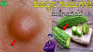 Lipoma Ayurvedic Treatment  lipoma mane maddu  lipoma ayurvedic treatment kannada  kobbina gantu [upl. by Adnohr]