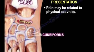 Kohlers Disease  Everything You Need To Know  Dr Nabil Ebraheim [upl. by Daney]