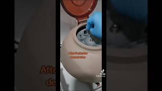 urinalysis Procedure laboratory mls cls medtechstudent urine urinetest [upl. by Latsyrcal]