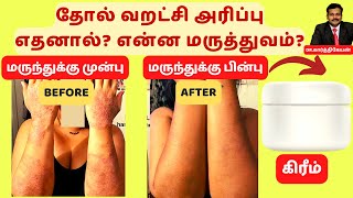 தோல் வறட்சி அரிப்பு நீங்க சூப்பர் மருத்துவம்  skin dryness itching home remedies dr karthikeyan [upl. by Rose]