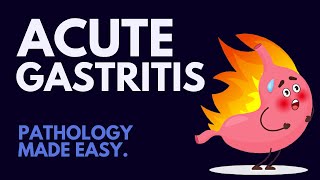 Acute Gastritis Pathology Simplified MUST KNOW [upl. by Eiddal]