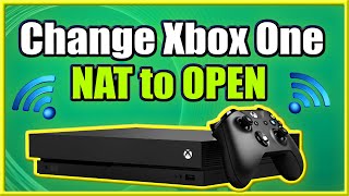 How to Change Xbox One NAT to OPEN and FIX Strict Connection Issues Easy Method [upl. by Carlock]