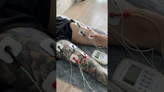 Electrotherapy and Exercises [upl. by Ydok]