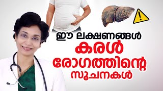 കരള്‍ രോഗം ശരീരം മുന്‍കൂട്ടി നല്‍കുന്ന അപായ ലക്ഷണങ്ങൾ  Fatty liver  Dr Jolly Thomson [upl. by Oivlis]