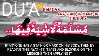 DUA FOR THE REMOVAL OF BLEMISH AND SCAR [upl. by Hgielrahc]