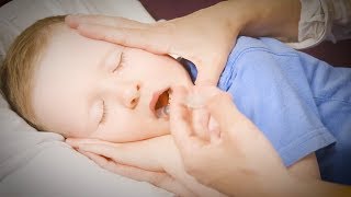 How to Give Your Child Buccal Midazolam [upl. by Idnyl933]