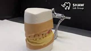 Dental Implants Conventional Lab Workflow [upl. by Garda]