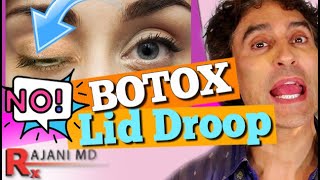 BOTOX EYELID DROOP Botox Before and After [upl. by Folberth]