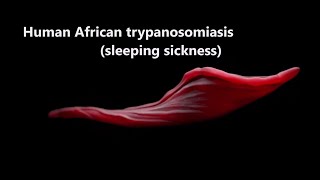 Human African Trypanosomiasis sleepingsickness Trypanosomiasis WHO [upl. by Aridan]