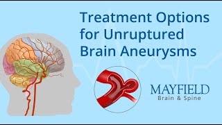 Treatment Options for Unruptured Brain Aneurysms [upl. by Twyla]