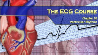 The ECG Course  Ventricular Rhythms [upl. by Perretta914]