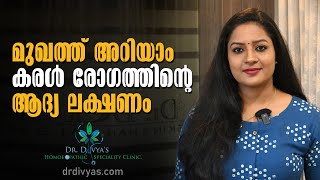 മുഖത്ത് അറിയാം കരള്‍ രോഗത്തിന്‍റെ ആദ്യലക്ഷണം  EARLY SIGNS amp SYMPTOMS THAT YOU HAVE A LIVER DISEASE [upl. by Erdreid583]