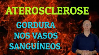 Aterosclerose O que significa [upl. by Tova]