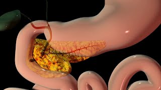 Pancreas Explained  3D Animation [upl. by Giefer477]