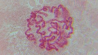 POLYTENE CHROMOSOME OF Drosophila sp FRUIT FLY [upl. by Sethrida]