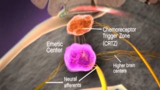 Physiology of Vomiting [upl. by Reinke743]